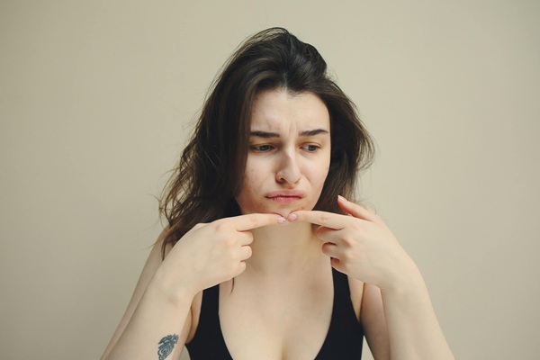 pmos-acne-hormonal-symptoms