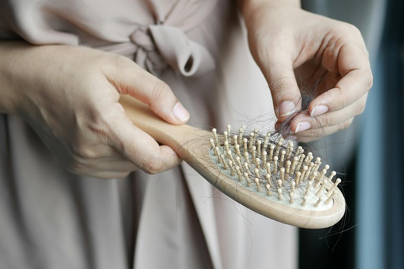 pmos-hair-thinning-hair-loss-symptoms